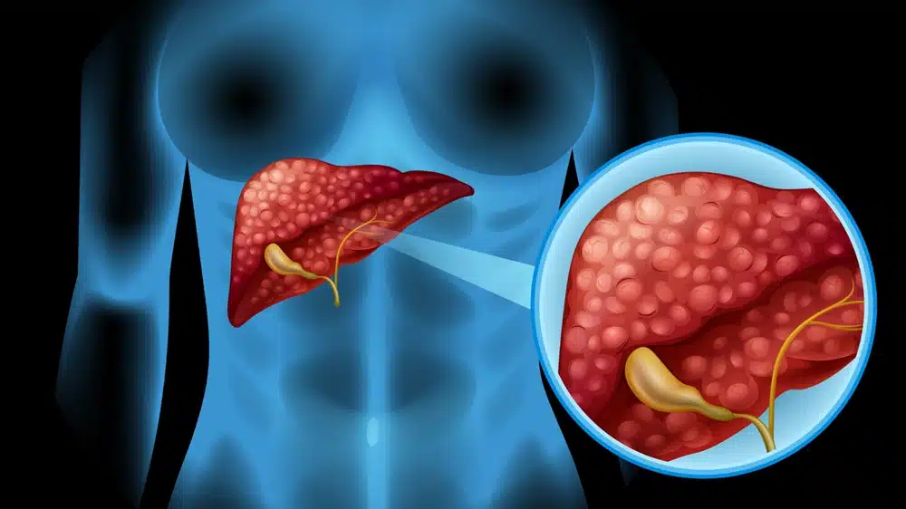 Ingredientes do suplemento Liver Cleanse