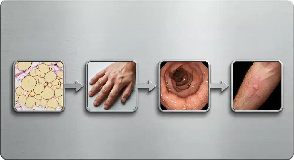 collagen-weight-gain-symptom-decision-tree Decision tree for collagen weight gain water retention bloating and puffy face
